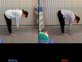 りらく整体 あおば/腰痛による前屈制限にアプローチ