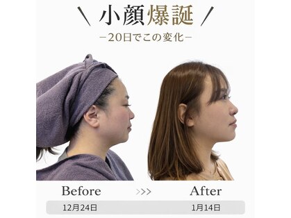 オン ザ スムース(ON THE SMOOOTH)の写真