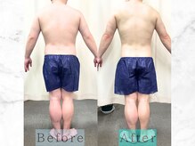 パラディ(PARADIS)/ハイパーナイフ/シェイプ/コルギ