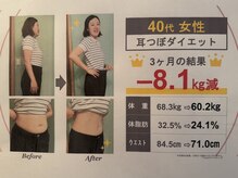 ジュンギンザ(JUN GINZA)/Before＆After