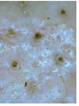 マヴィ くずは店(MavY.)/スコープで毛穴状態をチェック