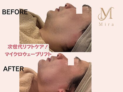 ミラ 札幌店(Mira)の写真
