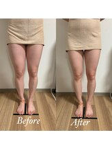 ホルバール 佐賀店(Hallbar)/ボディシェイプ