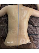 アトリエール(Ateliere)/たった1回で…驚きの変化が！！