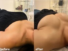 エムプリュ 心斎橋店(M.plus)/1回ですごい変化！！