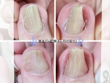 シャンティ(Shanti)