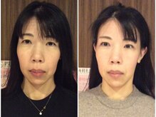 美容整体 ウェリナ 蟹江院/小顔矯正/骨盤矯正/美脚サロン 