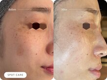 キュレイテッドスキン(CURATED SKIN)/