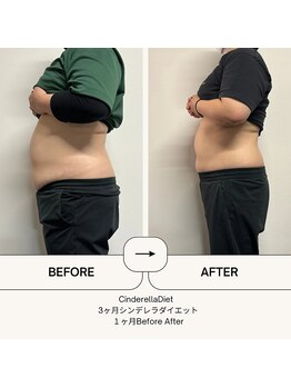 オーシャン整骨院(OCEAN整骨院)/６ヶ月ダイエットコース