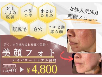 トレース