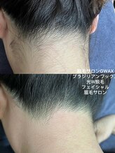 ジーワックス(G WAX)/おしゃれ女子の新常識うなじ脱毛