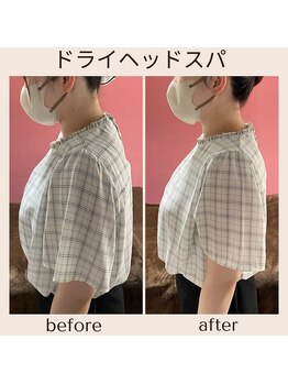 アルパカ(ALPAKA)/猫背、巻き肩に！美姿勢ケア！