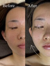 ルアーナ(LUANA)/