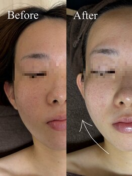 ルアーナ(LUANA)/