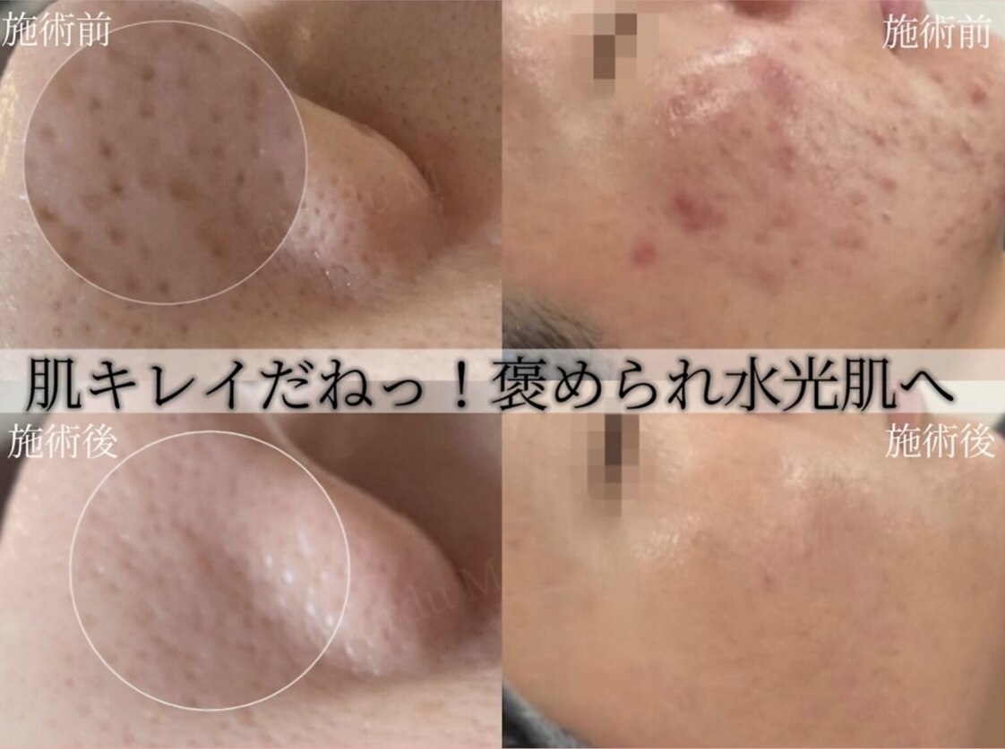 ハイフン(HIFUN)｜ホットペッパービューティー