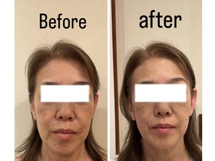 アンリール(ANRIRE)の写真