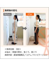 ただき接骨院 整体院 石原院/ お悩み：骨盤の開き、首肩凝り
