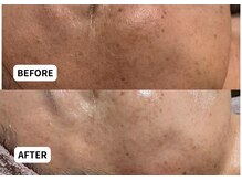 エルナ(Eluna)/美肌覚醒プログラム　セルマン