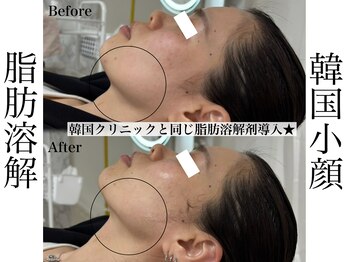 リベルキョウト 京都駅前店(Liber Kyoto)/レモンボトル超え!二重顎撃退