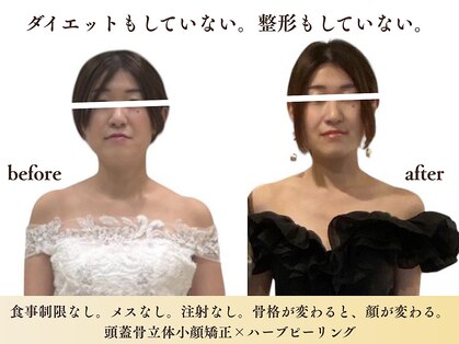 スカイ(sky)の写真