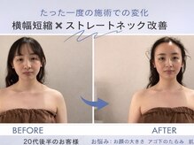 グレースフィオーレ 吉祥寺店(gracefiore)の雰囲気（頭皮から引き上げるテクニックで効果実感！眠れる小顔矯正☆）