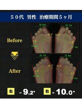 サラ(SARA)/