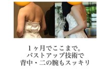 サロンハナ(Salon HANA)の雰囲気（ブライダルエステにも大人気☆二の腕背中痩せ¥11800）