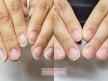 ミンスネイル(Mins Nail)/ファイリングbefore&after