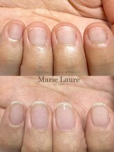 マリーロール 梅田店(Marie Laure)/自爪育成/深爪矯正/ネイルケア