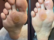 カラン(KARAN)/タコさん！！