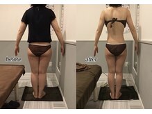 プレミアム ボディ ケア(Premium Body Care)/Before After 【30代】