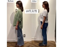 コルミチョン サロン(骨美整 salon)/40代女性　Before・After