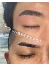 リモード(RI MODE)/メンズ脱毛