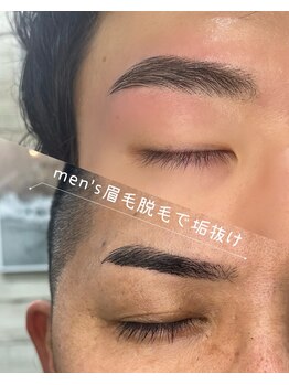 リモード(RI MODE)/メンズ脱毛