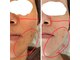 アスナ(ASUNA)の写真