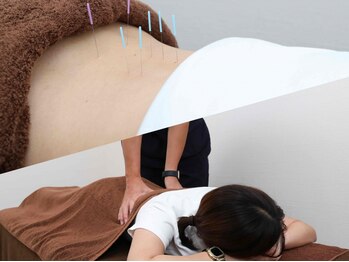 鍼灸整骨院ひでの写真/【慢性疲労、肩こり、腰痛、眼精疲労、頭痛、睡眠の質低下】などでお悩みの方へオススメ◎