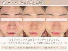 ミーカラー(mecalla.)の雰囲気（種類豊富な美肌ケアから最もお肌に合ったものでつやつや白玉肌に）