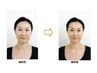 【限定】3名:理想の小顔へ【目元・フェイスライン・リフトアップ)】9900→
