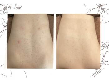 レゴリス 横浜店(REGOLITH)/