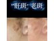 ポルテ(porte)の写真