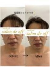 メディカルサロンドオフ 堺東店(medical salon de off)/光造顔フェイシャル★ &nbsp;施術前後