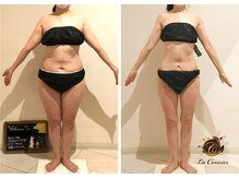ラ・コンシェル 青葉台店(La Concier)/Before after【青葉台店】