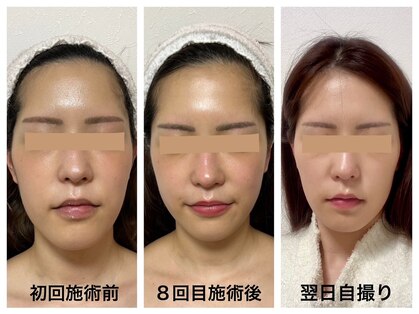 ダルセーニョの写真