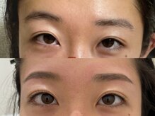 ビューティーベリッシモ(Beauty Bellissimo)/ニュアンスブロウリフト