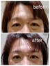【リスリー 70分コース】眼精疲労による頭痛/お顔のむくみやたるみに◎