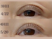 アイアンド(i&)/70代のお客様～施術経過～