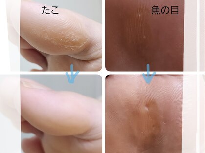 シャンティ(Shanti)の写真