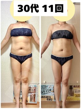 ヨサパーク ボニータ(YOSA PARK BONITA)/