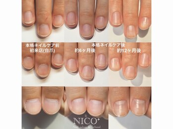 ニコプラス 大橋店(NICO+)/爪育ネイルケア