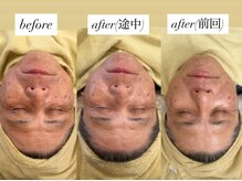 クレール(CLAIR)の雰囲気（【とにかくハリが出る施術】男性にも人気なフォトエレ★）